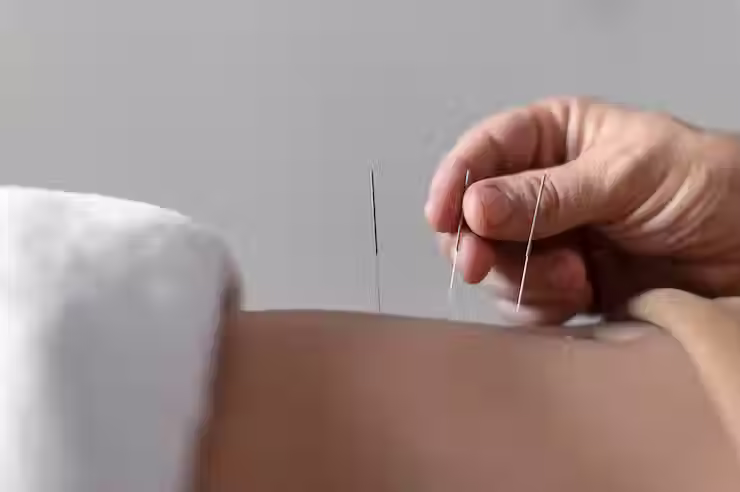 close-up-hand-holding-acupuncture-needle_23-2148815311.avif