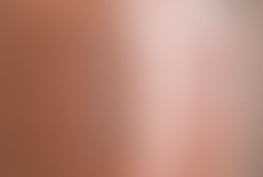 217712 - 5-Day Patch Test - £70