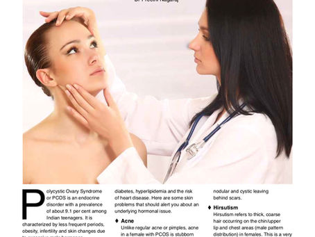 Skin changes due to PCOS