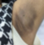 best dermatologist in Kochi