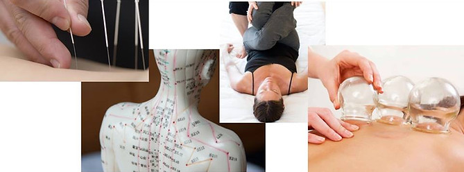 Traditional Chinese Medicine TCM Images Acupuncture Arcata