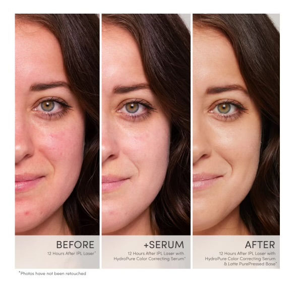 Thumbnail: HydroPure Colour Correcting Serum