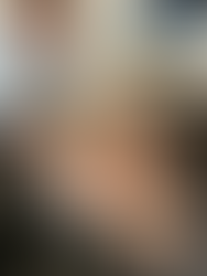 Integrative physical therapist performing soft tissue work on a patient using instrument assisted soft tissue massage to reduce pain and improve mobility of tissue