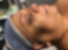 The Loft Skin Studio Customer before and after photo - before facial
