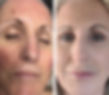 The Loft Skin Care Before and After facial of older woman