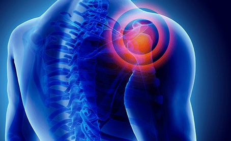 Understanding Musculoskeletal Disorders (MSD)