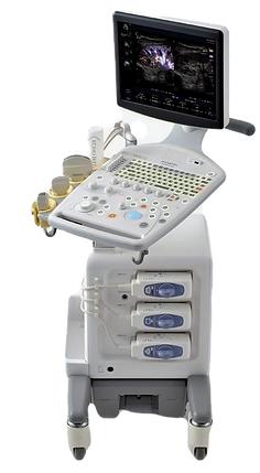 Hitachi-Aloka-Prosound-F37-Ultrasound-Ma