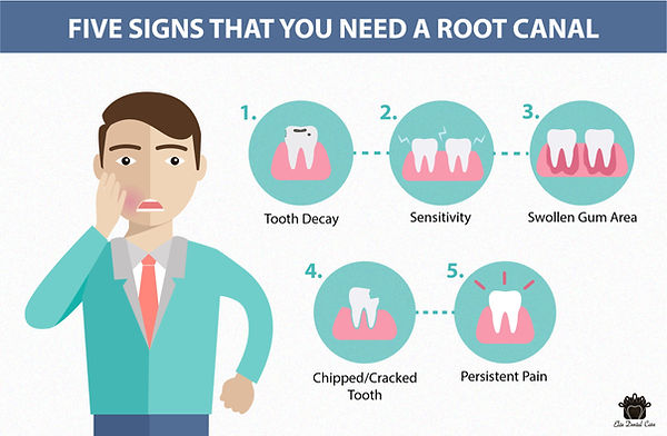 Root-Canal-02-scaled.jpg