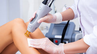 Can You Get Full Body Laser Hair Removal? 