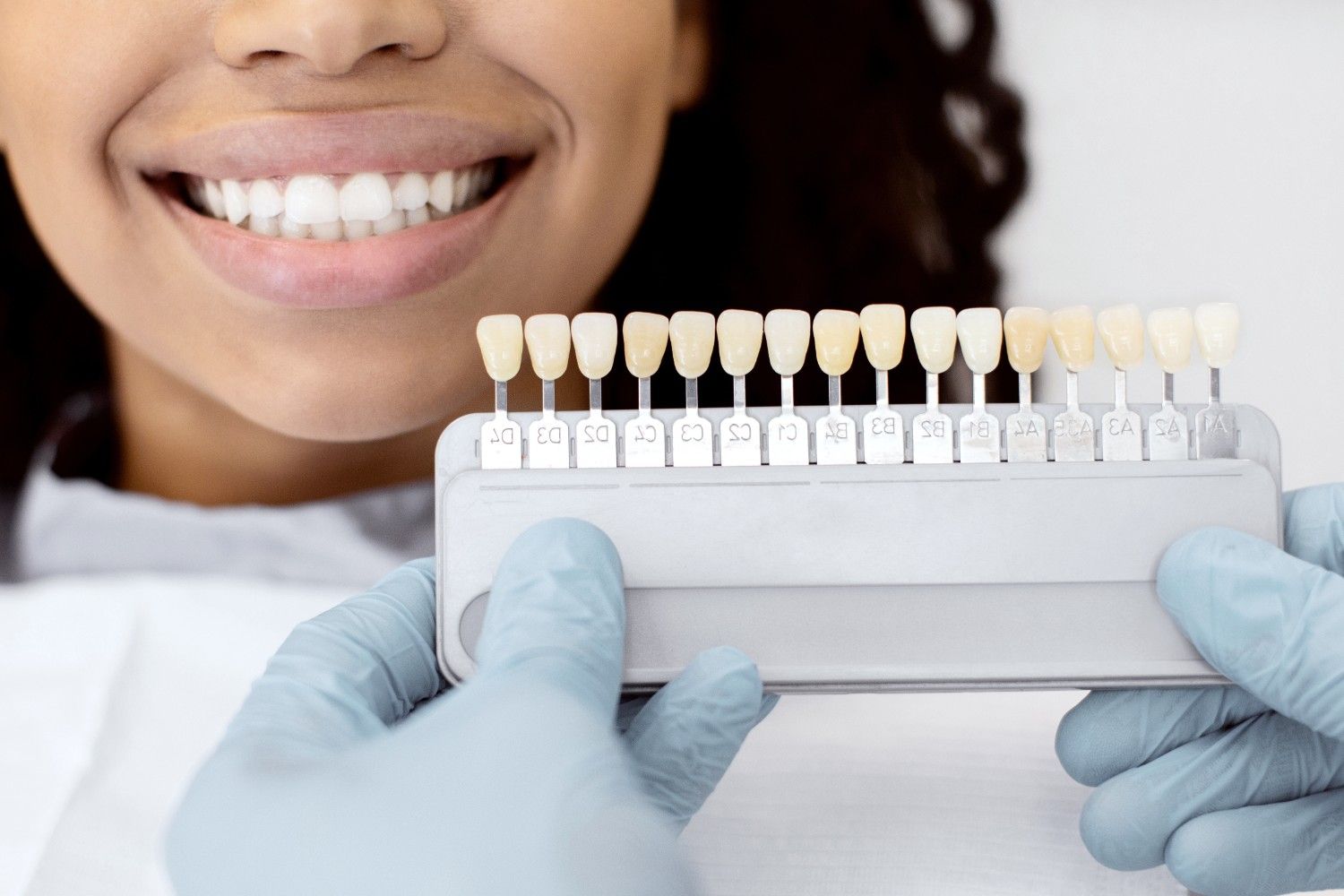 How Much Does Zoom Teeth Whitening Cost in Sydney? — dental article from Newtown Elite Dental