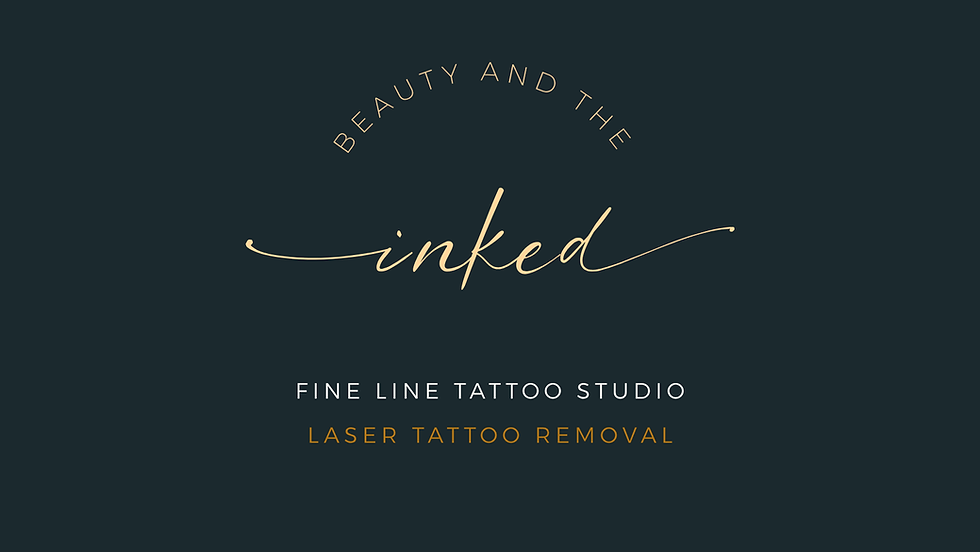 Laser Tattoo Removal Idle