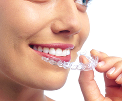 Ortodoncia Invisalign