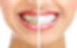 Periodoncia