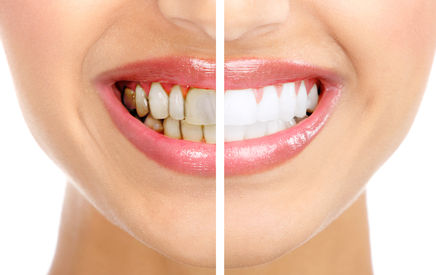 Periodoncia