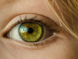 VITREOUS FLOATERS
