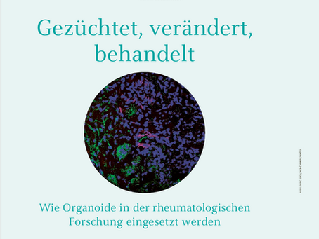 Featured in HHU Magazin: Organoid Research in Rheumatology