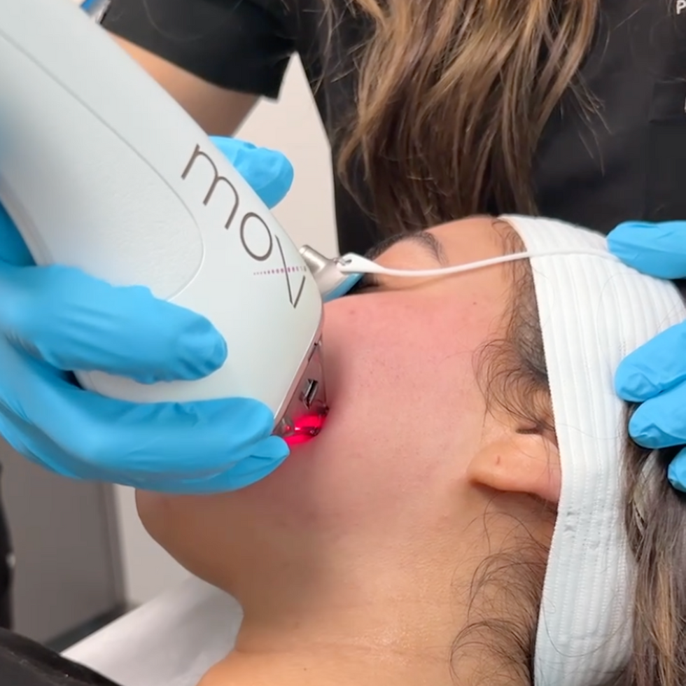 Moxi Laser