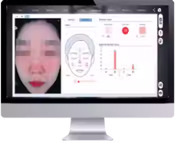 FaceX Pro system for advanced aesthetic and medical treatments, distributed in Canada by Aya Medical