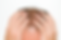 hair fall