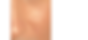 Oily-Skin-Do-I-Need-a-Moisturizer-copy