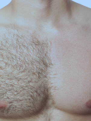 EPILFREE WAXING