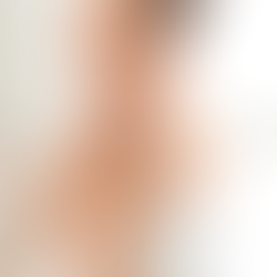 Tu Rutina Ideal Para La Queratosis Pilaris