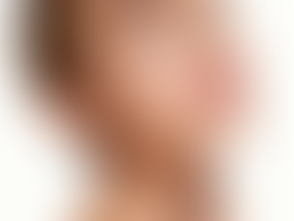 Guía Para Sobrevivir A Los Granitos