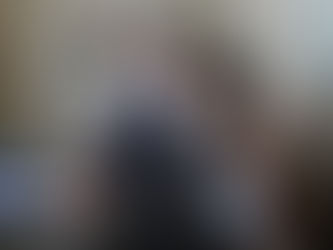 Se confirmó el primer caso de Viruela Símica en Tucumán