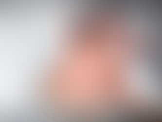 Viruela del mono: confirman el tercer caso en Argentina