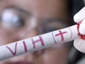Prueban en humanos una vacuna contra el VIH