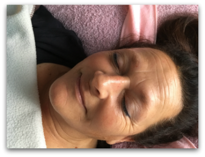 Jane Goodman's Cosmetic Acupuncture: After #4