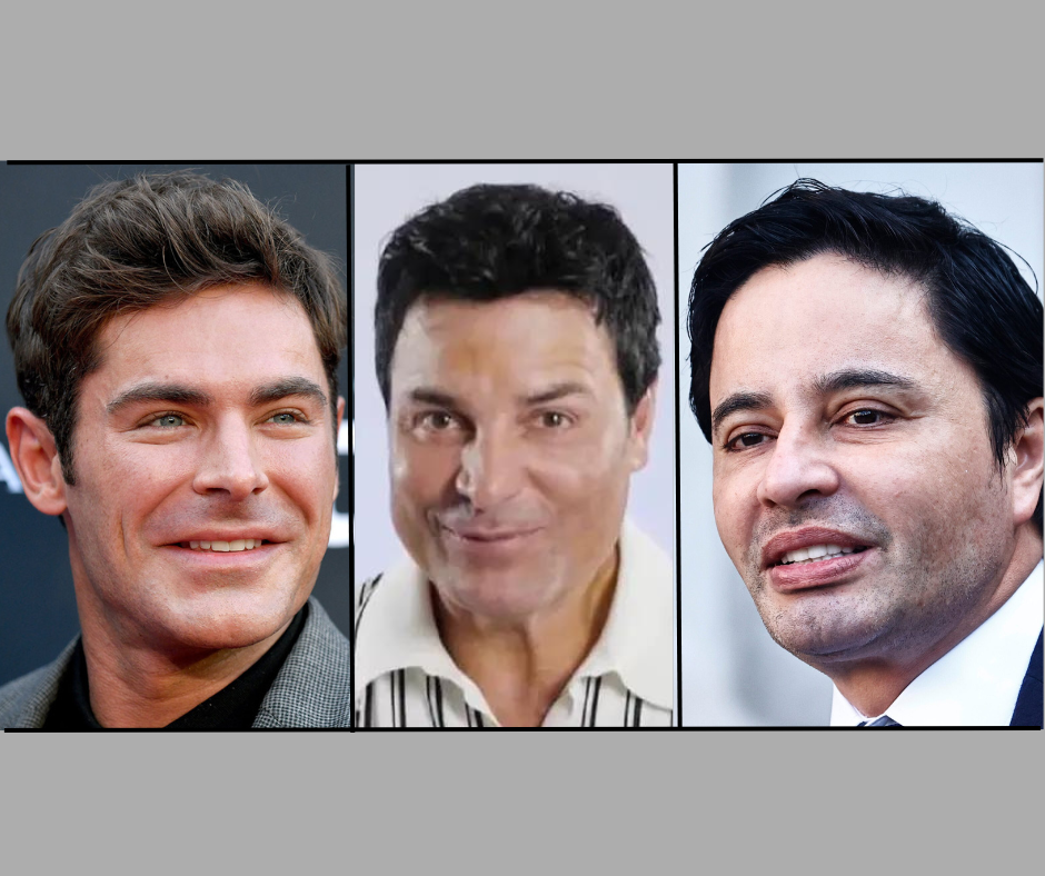 ¿Por qué el botox aún tiene mala fama en Chile y en el mundo?