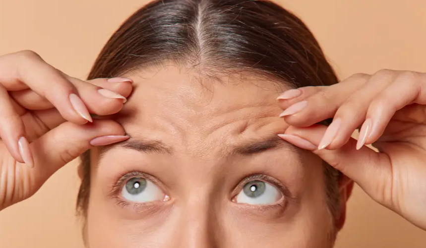 ¿Por qué pueden caer las cejas después de aplicarse toxina botulínica?