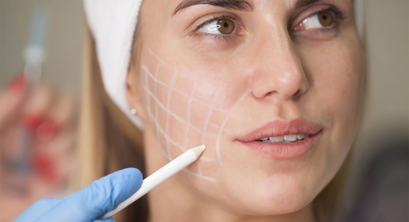 Sculptra vs HArmonyCa: ¿Cuál es mejor para ti?