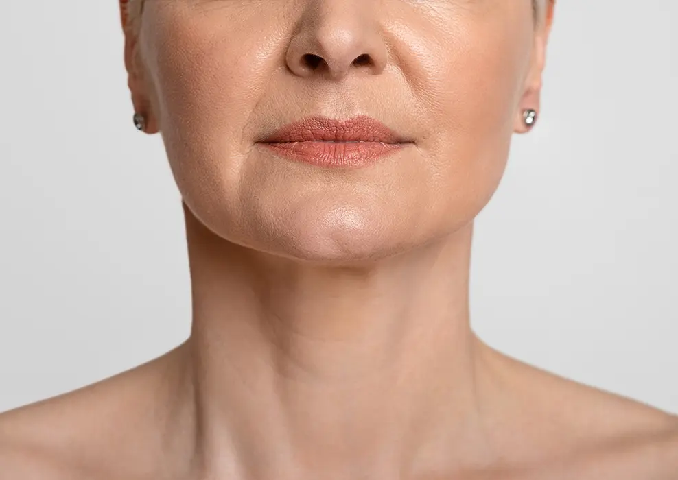Sculptra Antes y Después: Resultados Reales del Bioestimulador de Colágeno Más Famoso