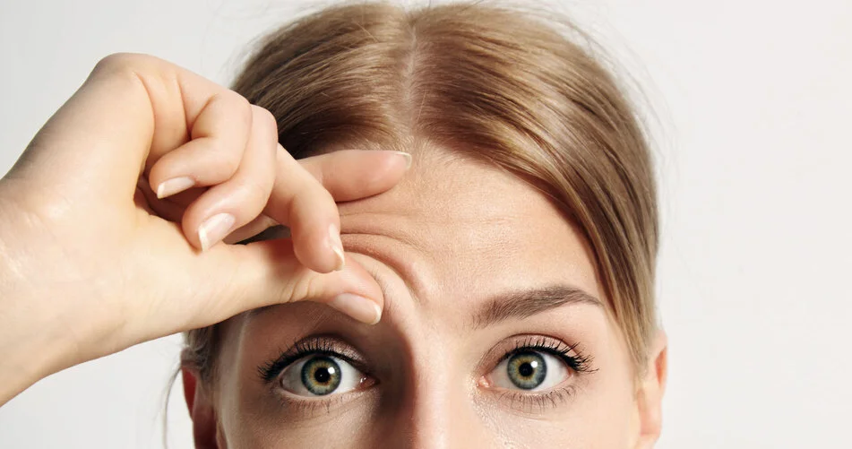 botox ¿qué es y para qué sirve?