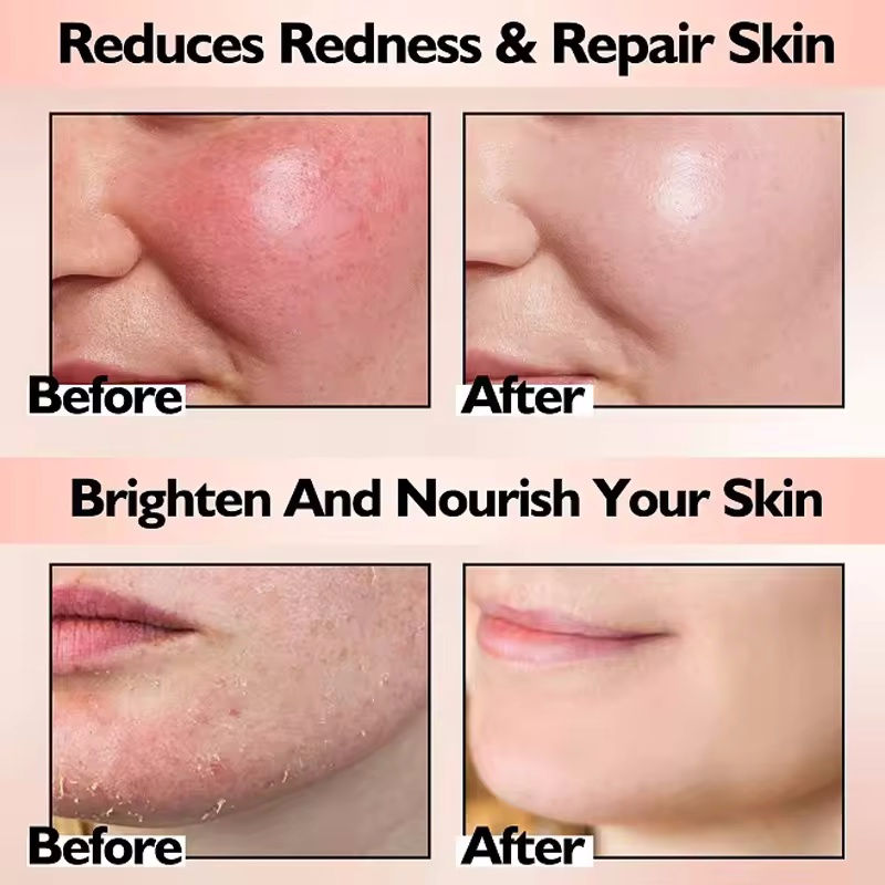 Thumbnail: 1/3/5/10pcs Pink Bio Collagen Face Mask Anti Wrinkle Fade Face Fine Line Lift Fi