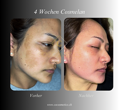 Schwarz Weiß Elegant Minimal Vorher Nachher Foto Maniküre Beauty Instagram Post.png