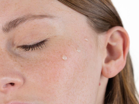 Pourquoi la peau perd son équilibre ?