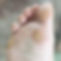VerrugasPies.jpg