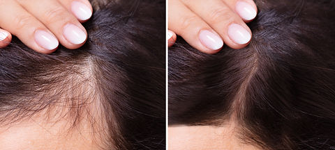 prp-treatment-v1.jpg