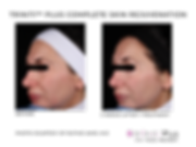 TRINITI BEFORE AND AFTER-04-04.png