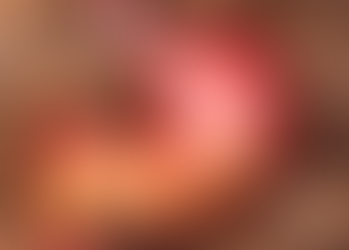 Doença do Refluxo Gastroesofágico