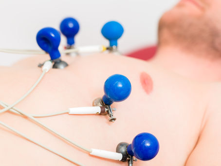 Exame de Eletrocardiograma