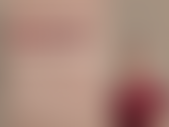 Half price laser hair removal training appointments at The Appearance Clinic Rotorua with Alex supervised by Michelle