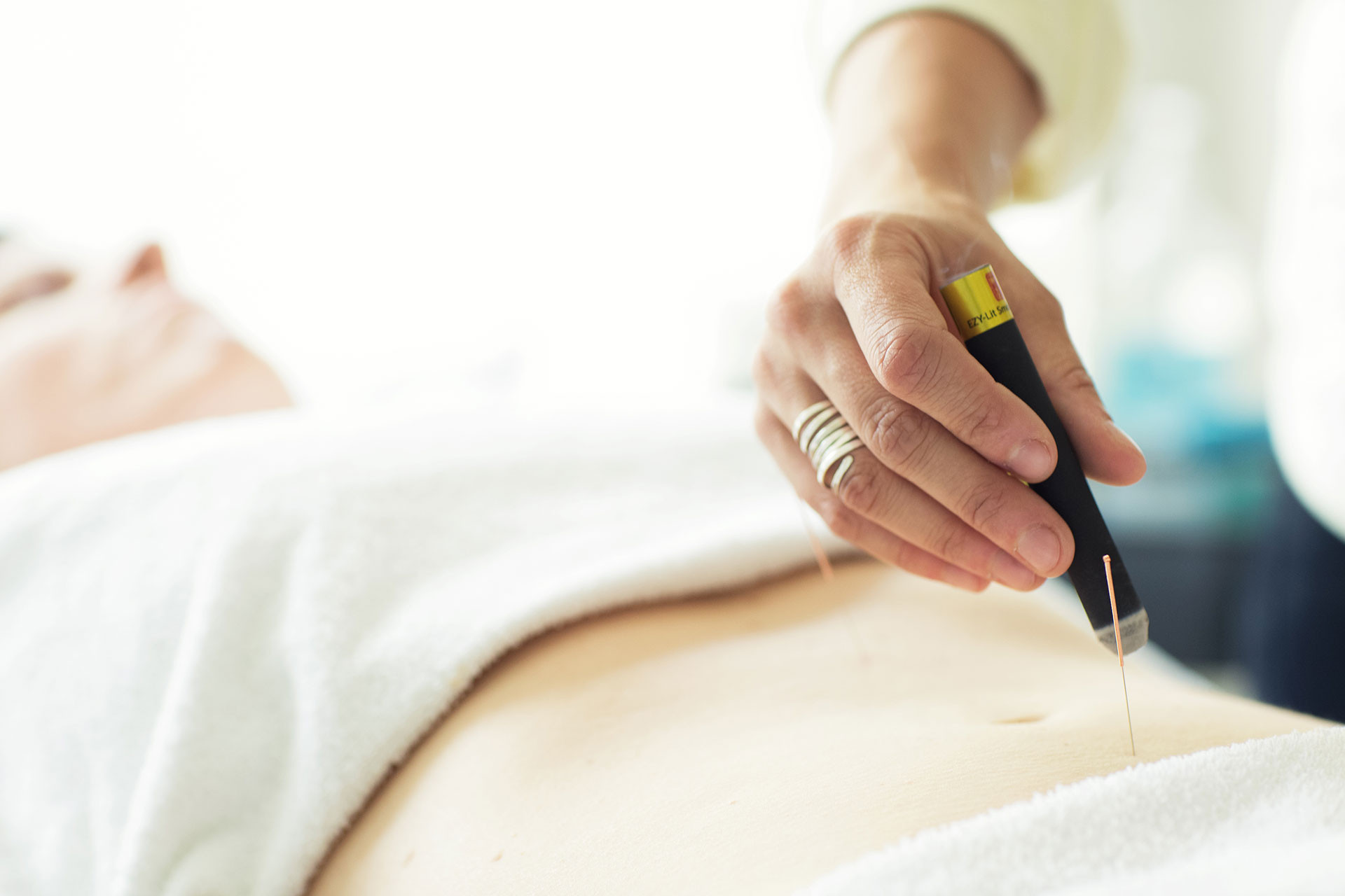 Acupuncture Clinique Complice Santé