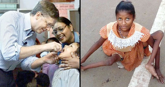 47,000 CHILDREN CRIPPLED AND PERMANENTLY PARALYSED IN INDIA, BILL GATES' POLIO VACCINE