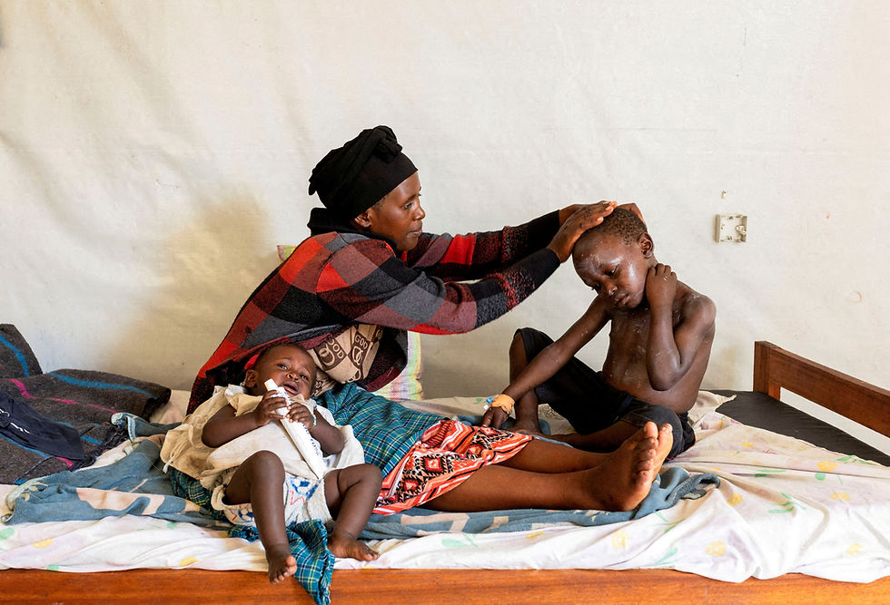 Elisabeth Furaha applies medication on the skin of her child Sagesse Hakizimana who is under treatment for Mpox, an infectious disease caused by the Mpox virus that causes a painful rash, enlarged lymph nodes and fever, at a health centre in Munigi, Nyiragongo territory, near Goma in North Kivu province of the Democratic Republic of Congo August 19, 2024. /Arlette Bashizi//File Photo