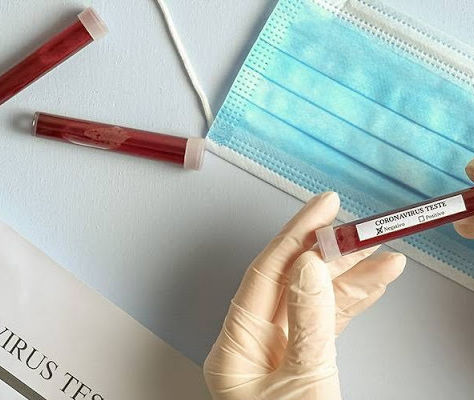 Prefeitura descarta 4 casos suspeitos de coronavírus em Ibiá