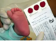 Minas Gerais se torna o primeiro estado do Brasil a oferecer Teste do Pezinho ampliado para 60 doenças